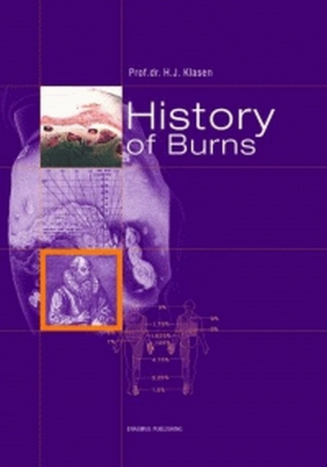 History of burns